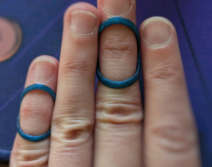 Finger ring splint for high mobility joints